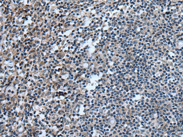 UGT8 Polyclonal Antibody – Figure 1 of 2