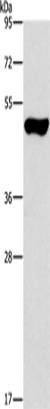 ILK Polyclonal Antibody – Figure 1 of 4