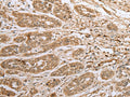 ATXN7L3 Polyclonal Antibody – Figure 1 of 3