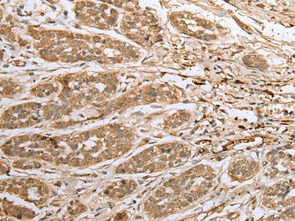 ATXN7L3 Polyclonal Antibody – Figure 1 of 3