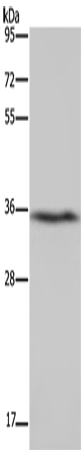 DDAH1 Polyclonal Antibody – Figure 1 of 4