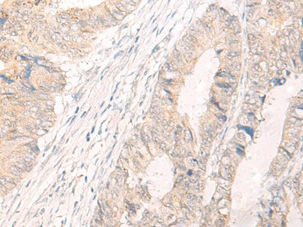 IL33 Polyclonal Antibody – Figure 1 of 3