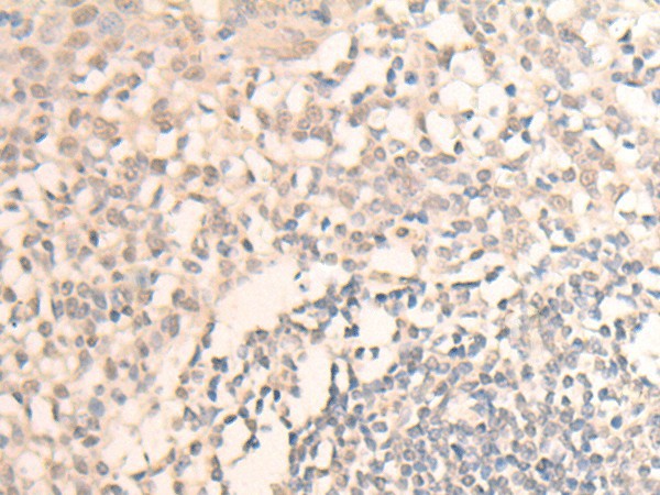 MLLT6 Polyclonal Antibody – Figure 1 of 2