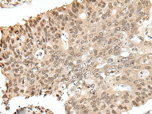 ZNF410 Polyclonal Antibody – Figure 1 of 3