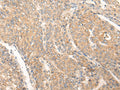 PIAS3 Polyclonal Antibody – Figure 1 of 3