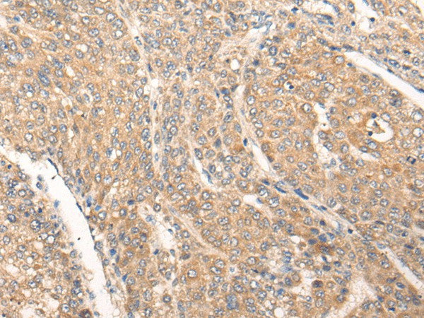 PIAS3 Polyclonal Antibody – Figure 1 of 3
