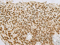 TP63 Polyclonal Antibody – Figure 1 of 2