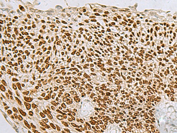 TP63 Polyclonal Antibody – Figure 1 of 2