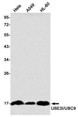 Recombinant SUMO Conjugating Enzyme UBC9 Monoclonal Antibody – Figure 1 of 3