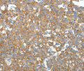 GEMIN2 Polyclonal Antibody – Figure 1 of 3