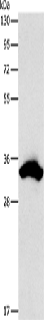 CDCA8 Polyclonal Antibody – Figure 1 of 4