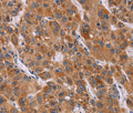 CALCA Polyclonal Antibody – Figure 1 of 3