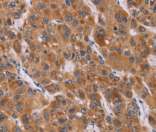 CALCA Polyclonal Antibody – Figure 1 of 3