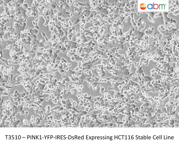 PINK1-YFP-IRES-DsRed Expressing HCT116 Stable Cell Line | Applied Biological Materials (abm)