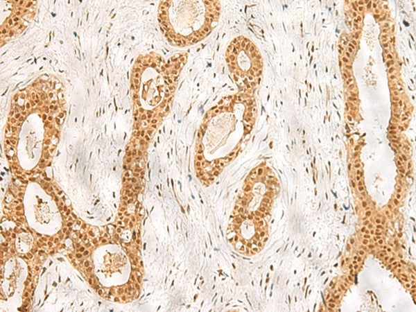 RPS27A Polyclonal Antibody – Figure 1 of 3