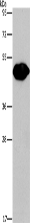 PLIN2 Polyclonal Antibody – Figure 1 of 4