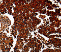 ANXA7 Polyclonal Antibody – Figure 1 of 3