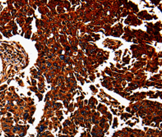 ANXA7 Polyclonal Antibody – Figure 1 of 3