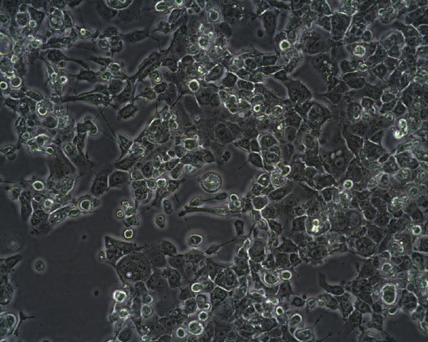 Zajdela-Hepatoma cell
