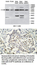 Anti-ZAP70 Antibody – Figure 1 of 1