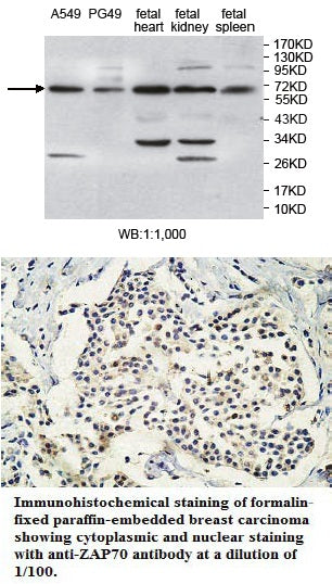 Anti-ZAP70 Antibody – Figure 1 of 1