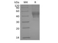 Recombinant Human Signal Transducer CD24/CD24 (C-mFC) – Figure 1 of 2
