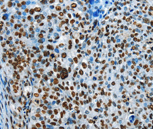 CREB1 Polyclonal Antibody – Figure 1 of 3