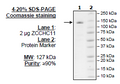 TUT4, FLAG-tag (Human) Recombinant – Figure 1 of 2