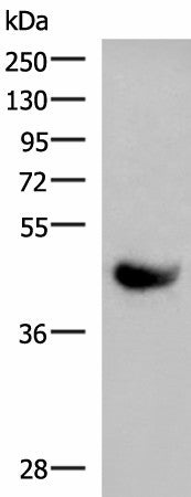 KIR2DL5A Polyclonal Antibody – Figure 1 of 3