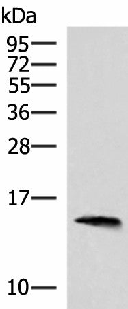 REG1B Polyclonal Antibody – Figure 1 of 3