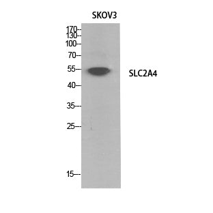 GLUT-4 Polyclonal Antibody – Figure 1 of 4