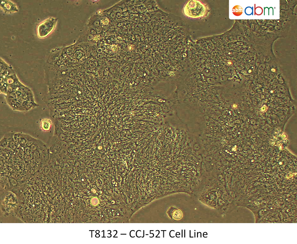 CCJ-52T Cell Line | Applied Biological Materials (abm)