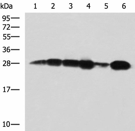 MMAB Polyclonal Antibody – Figure 1 of 2