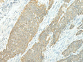 ETAA1 Polyclonal Antibody – Figure 1 of 3
