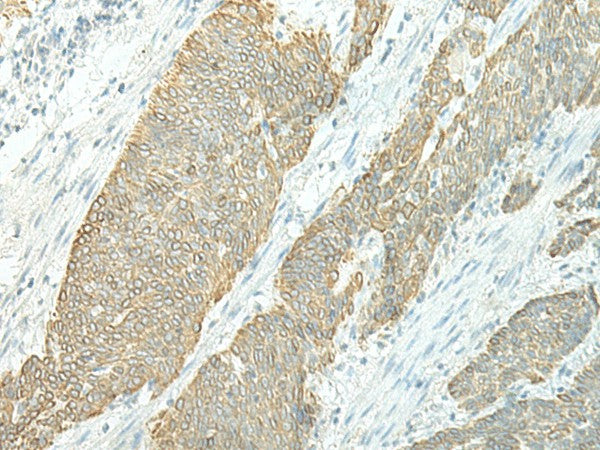 ETAA1 Polyclonal Antibody – Figure 1 of 3