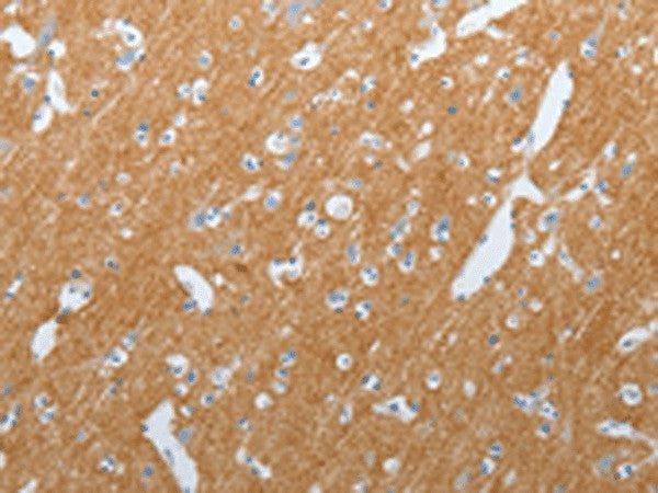 SLC17A7 Polyclonal Antibody – Figure 1 of 2