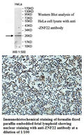 Anti-ZNF22 Antibody – Figure 1 of 1