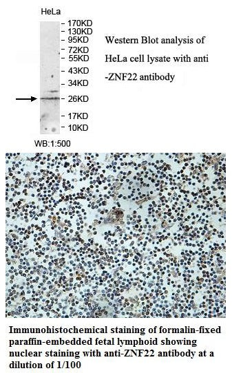 Anti-ZNF22 Antibody – Figure 1 of 1