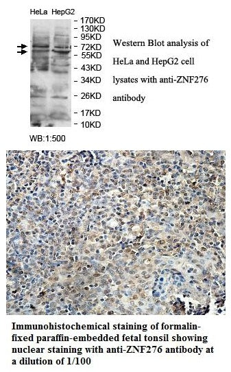 Anti-ZNF276 Antibody – Figure 1 of 1