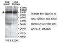 Anti-ZNF33B Antibody – Figure 1 of 1