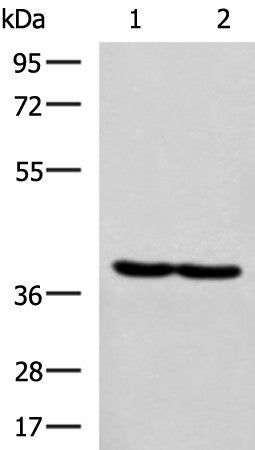RBM4 Polyclonal Antibody – Figure 1 of 2