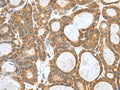 KANSL1L Polyclonal Antibody – Figure 1 of 2