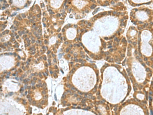 KANSL1L Polyclonal Antibody – Figure 1 of 2