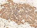CLK2 Polyclonal Antibody – Figure 1 of 3
