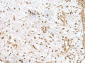 AK6 Polyclonal Antibody – Figure 1 of 2
