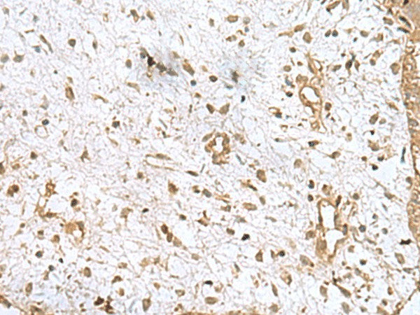 AK6 Polyclonal Antibody – Figure 1 of 2