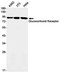Recombinant Glucocorticoid Receptor Monoclonal Antibody – Figure 1 of 3