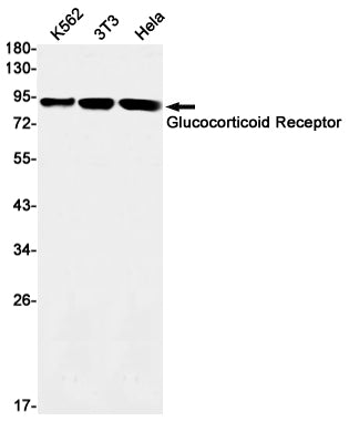 Recombinant Glucocorticoid Receptor Monoclonal Antibody – Figure 1 of 3