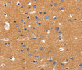 JAK2 Polyclonal Antibody – Figure 1 of 3